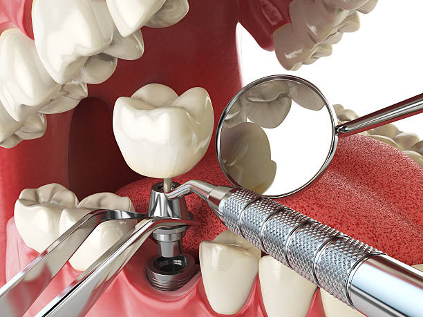 Best Emergency Denture Repair in Mount Hermon, VA